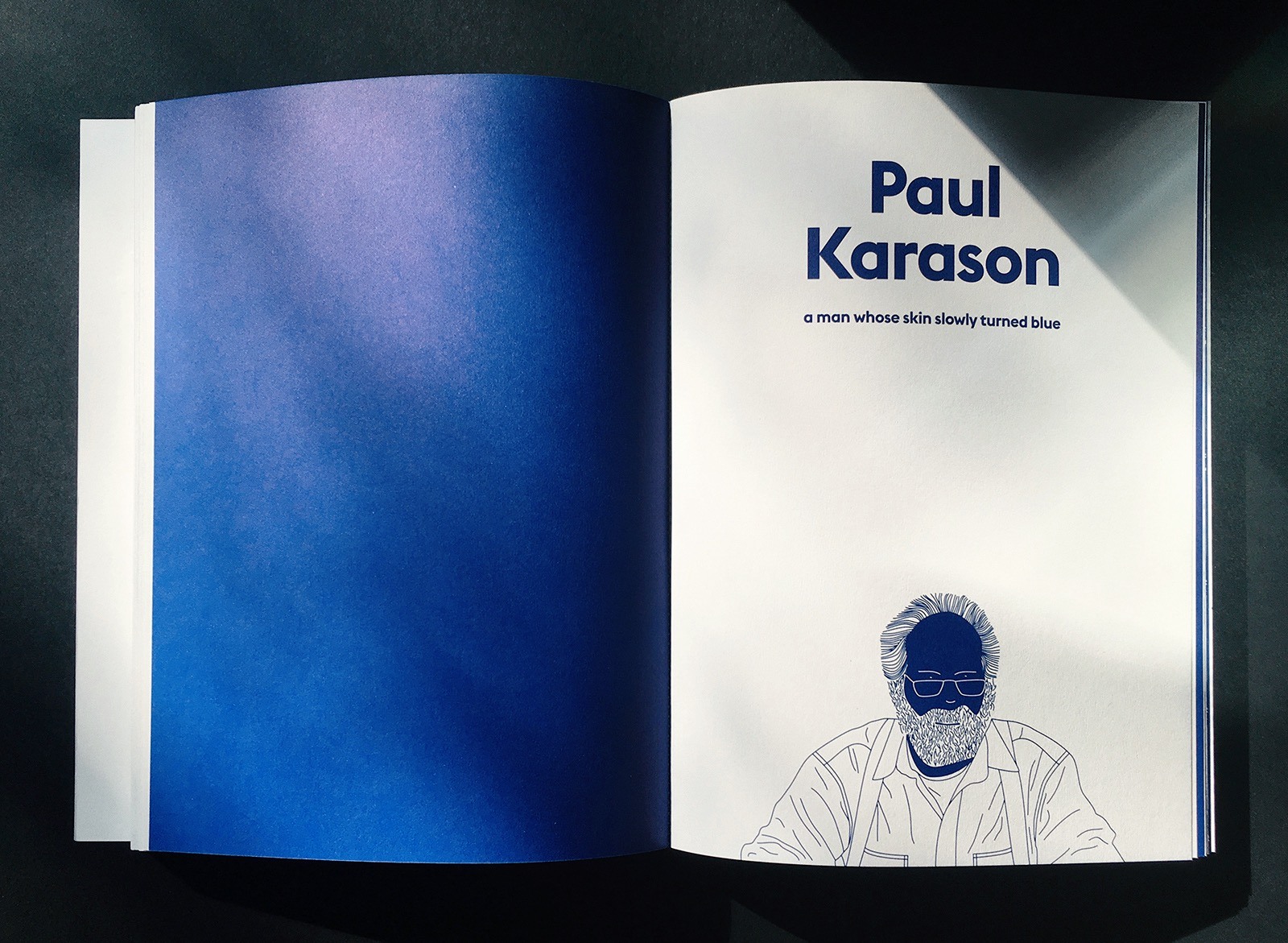 Paul Karason  The Man With Blue Skin 